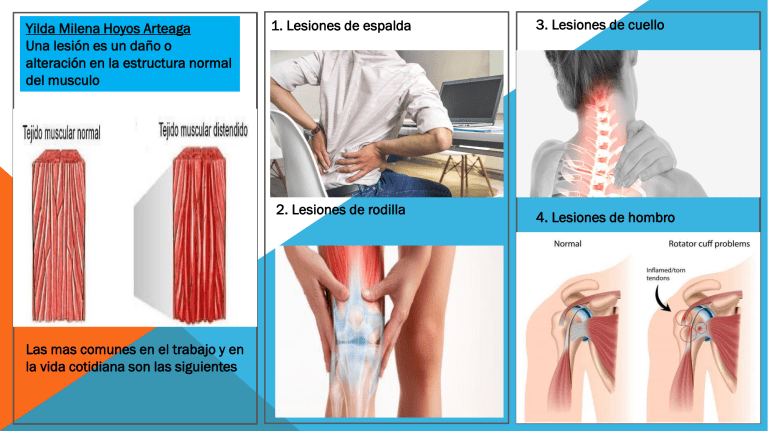 Folleto Lesiones Mas Comunes Pdf