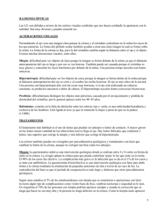 Alteraciones visuales