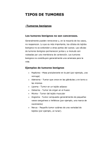 Tumores malignos