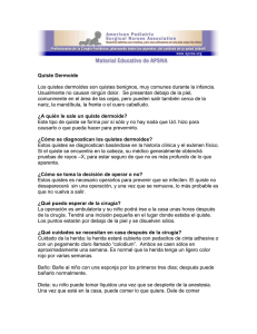 ¿A quién le sale un quiste dermoide?