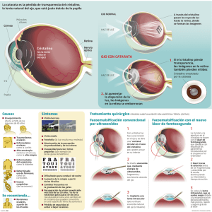 Causas Se recomienda... Síntomas Cristalino OJO CON