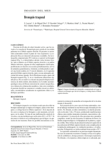 Bronquio traqueal - Revista de Patología Respiratoria