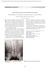 Doble sistema pieloureteral bilateral incompleto