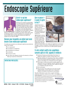 Qu`est-ce qu`une endoscopie supérieure? Raisons pour