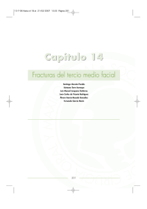 Fracturas del tercio medio facial - Sociedad española de cirugía oral