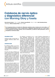 Coloboma de nervio óptico y diagnóstico diferencial con Morning
