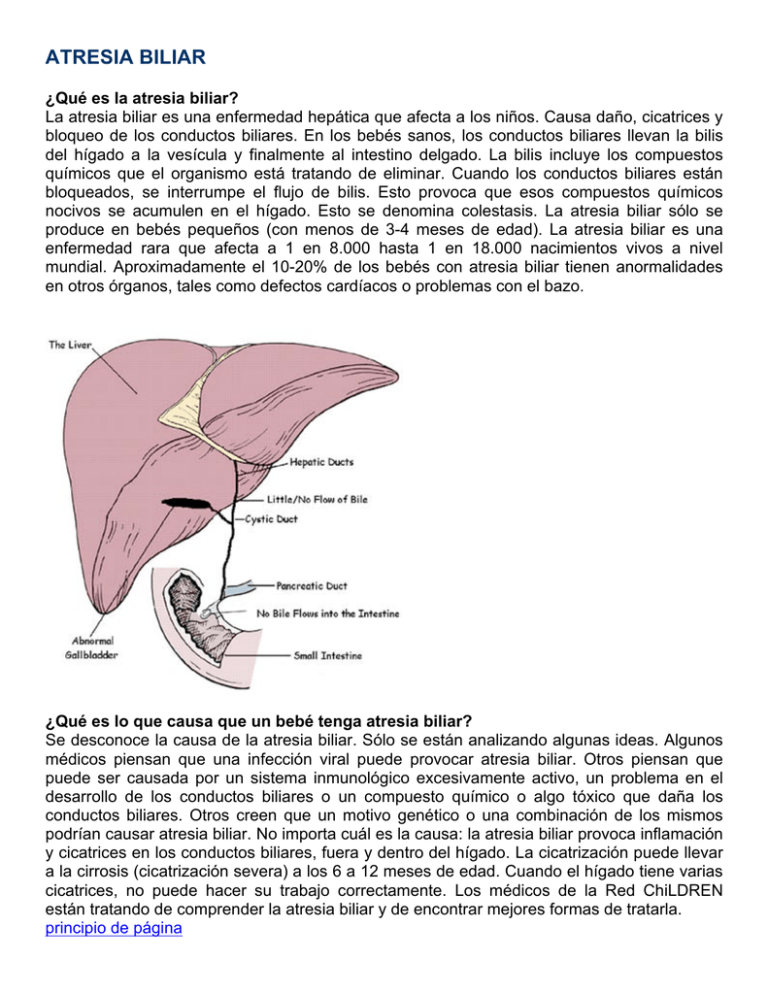 ATRESIA BILIAR