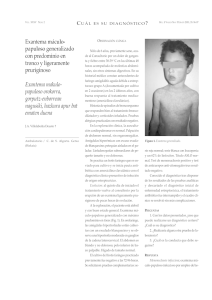 Exantema máculo- papuloso generalizado con predominio en