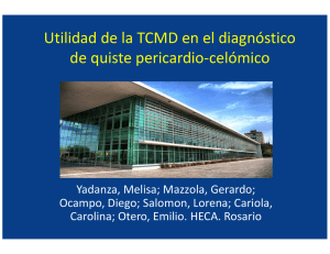 Utilidad de la TCMD en el diagnóstico de quiste pericardio