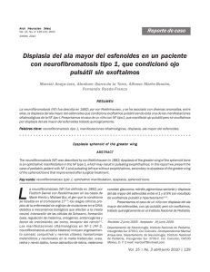 Displasia del ala mayor del esfenoides en un