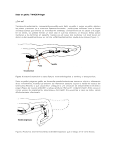 Dedo en gatillo (TRIGGER finger) ¿Qué es? Tenosinovitis