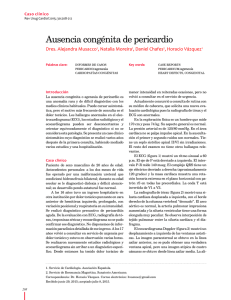 Ausencia congénita de pericardio