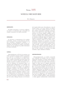 Tema 105 NÓDULO REUMATOIDE