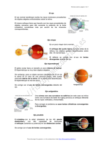 El ojo El ojo normal (emétrope) recibe los rayos luminosos