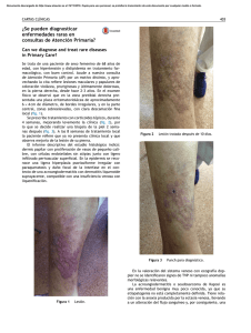 ¿Se pueden diagnosticar enfermedades raras en consultas de