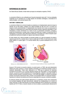 enfermedad de ebstein