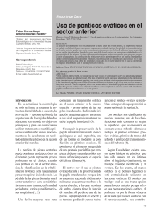 Uso de ponticos ováticos en el sector anterior