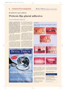Prótesis fija plural adhesiva - Dental Tribune International