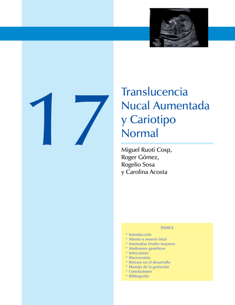 Cap tulo De Muestra