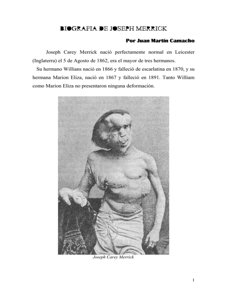 BIOGRAFÍA DE JOSEPH MERRICK