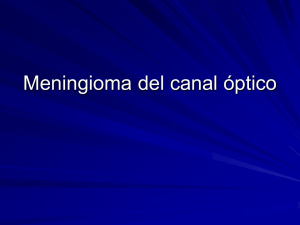 Meningioma del canal óptico - Hospital Ruber Internacional