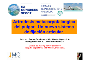 Artrodesis MCF Pulgar: Nuevo Sistema de Fijación IO Fix