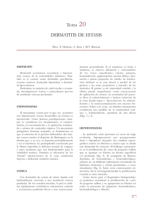 Tema 20 DERMATITIS DE ESTASIS