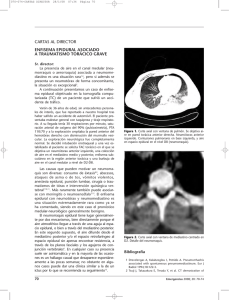 enfisema epidural asociado a traumatismo torácico
