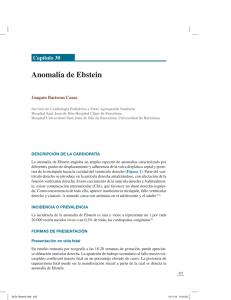 Anomalía de Ebstein