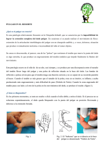 14 PULGAR EN RESORTE