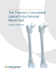 lateral entry femoral nail surgical technique guide