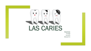 Caries: Definición, Causas y Prevención